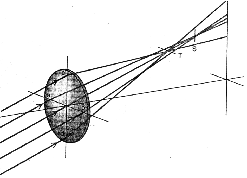 transverse, sagittal defined